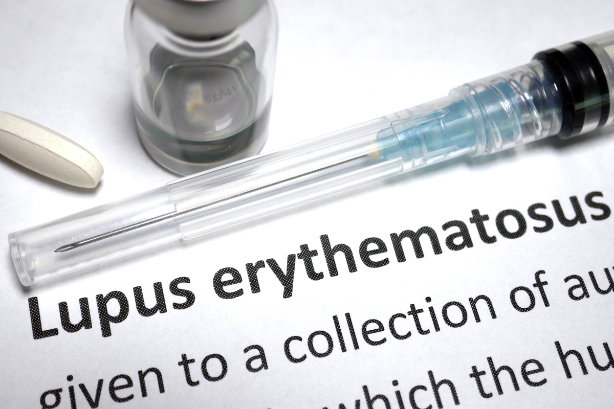 First Patient Dosed with NK Cell Therapy for the Treatment of an Autoimmune Disease, Lupus Nephritis