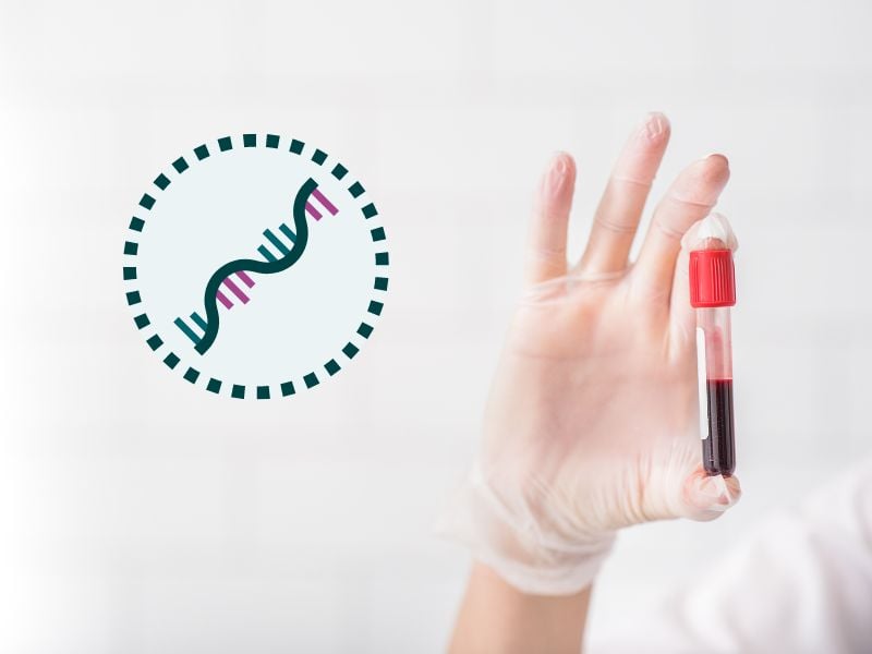 Liquid Biopsy for Early-Stage Pancreatic Cancer, Data Presented at AACR