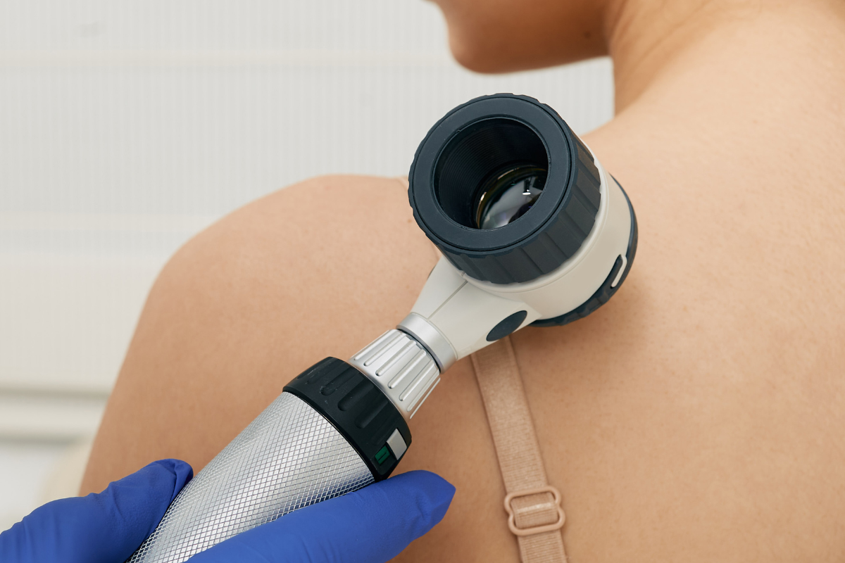 Patients Enter Clinic for Phase III mRNA Immunotherapy for High Risk Melanoma