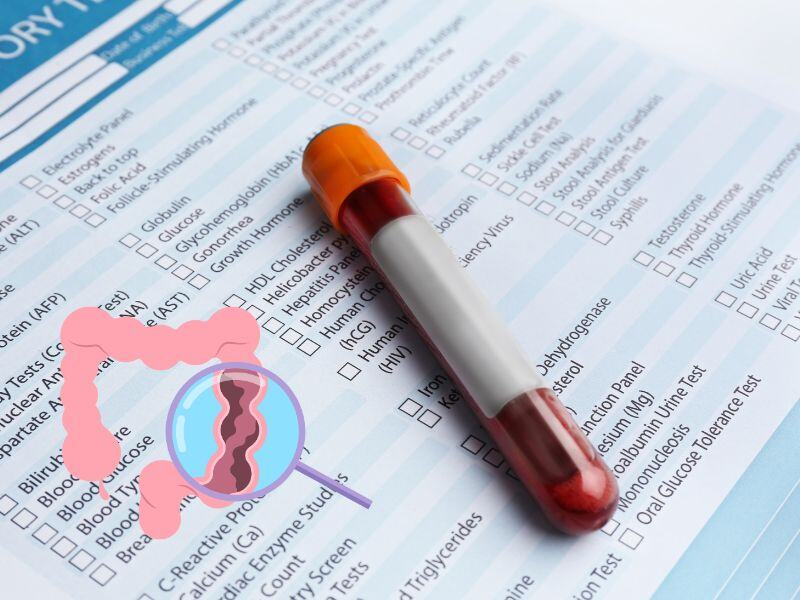 FDA Advisors Back Guardant Health’s Colorectal Cancer Blood Test