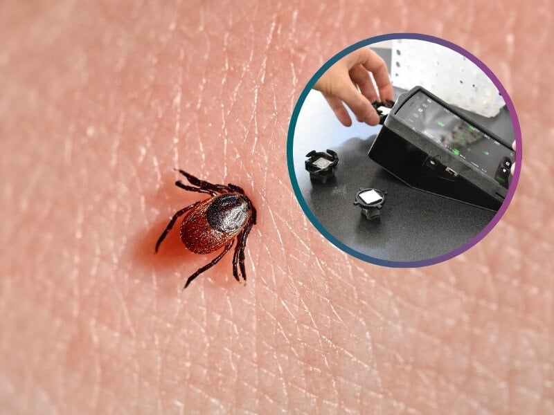 AI analysis of patient serum presents promising new Lyme disease diagnosis tool